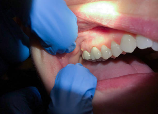 Best Weekend Emergency Dental Services in Elsberry, MO